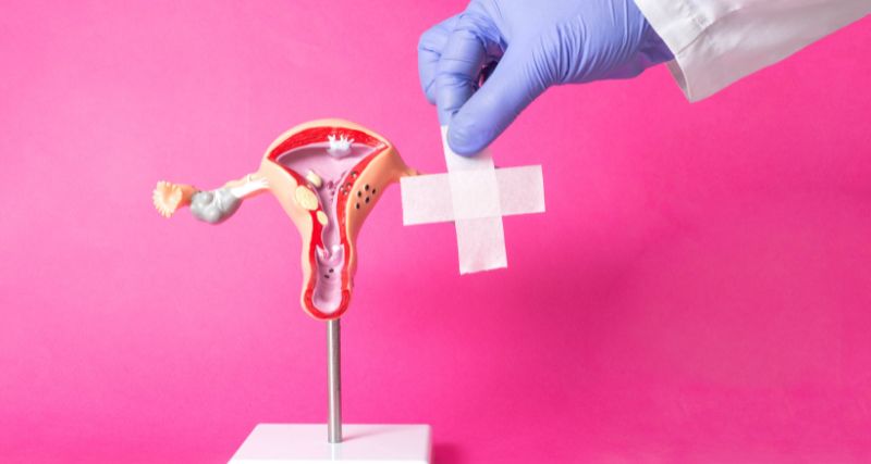 Maestría en Endometriosis