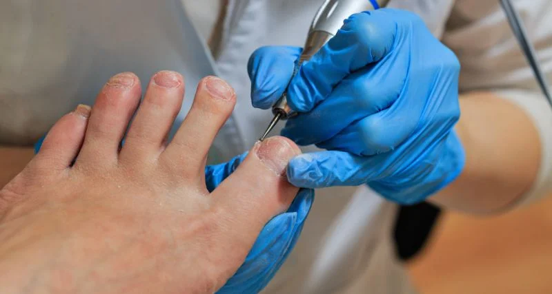 Diplomado en podología estética