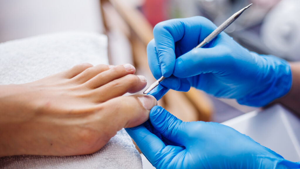 Diplomado en podología estética