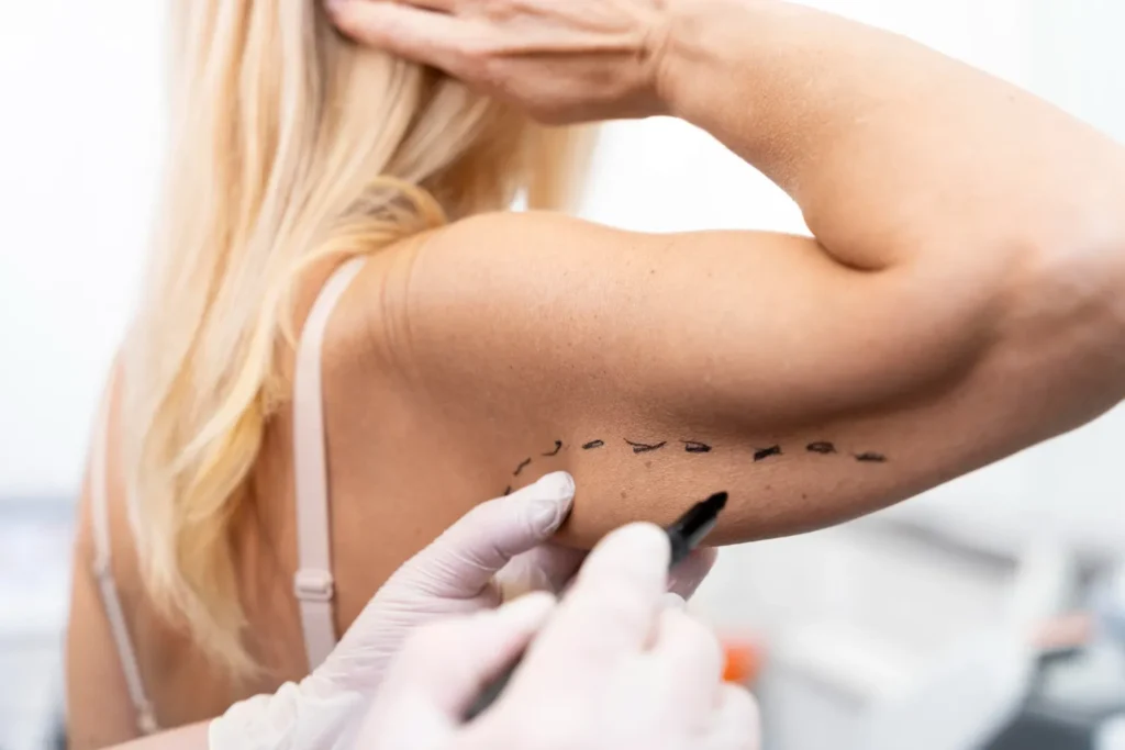 Maestría en Lifting Corporal Brazos Muslos y Flancos Avanzado 3