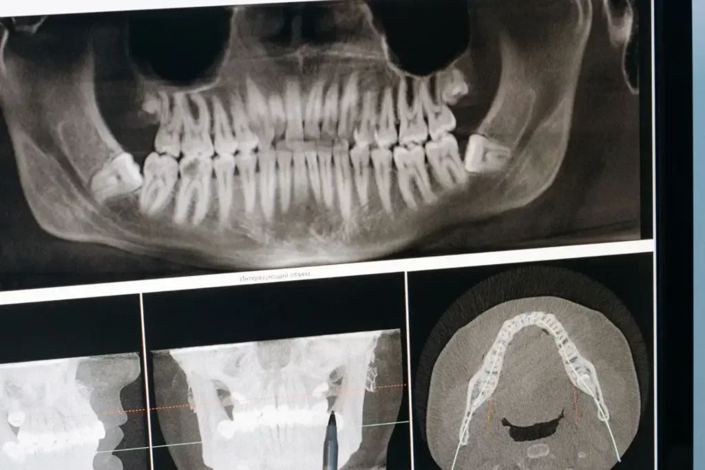Maestría en Odontología Digital 2