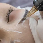 Curso de microblanding