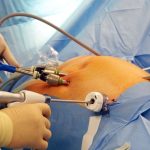 Maestría en Oncología Torácica