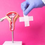 Maestría en Endometriosis