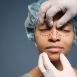 Maestria-en-Cirugia-Estetica-Facial-Rinoplastia-Blefaroplastia-y-Rejuvenecimiento-1