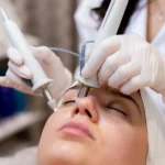 Maestría en Láser Dermatológico para Patología y Estética Vasculares y Pigmentarias 1