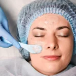 Maestría en Peelings y Dermatología Estética Clínica 1