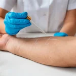 Maestría en Skin Barrier y Reparación Cutánea Microbioma y Barrera 1