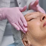 Máster en Enfermería en Peelings, Microneedling y Procedimientos Dermoestéticos 2